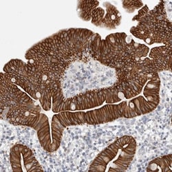 C1orf112 Antibody, Novus Biologicals 0.1mL; Unlabeled:Antibodies, Polyclonal